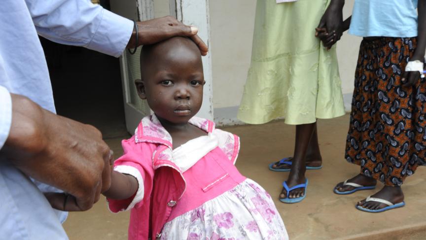 A young Burkitt's lymphoma patient.